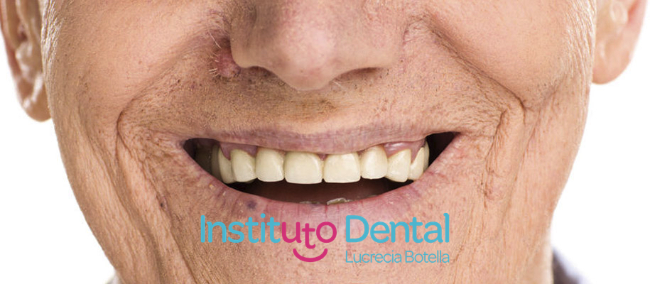 SOME TIPS FOR AN EXCELLENT DENTAL IMPLANT CARE