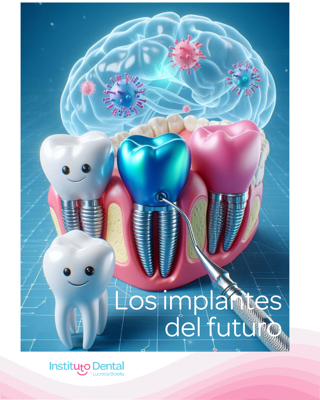 🦷 Un Futuro Más Sensible: Así Serán los Implantes Dentales del Mañana