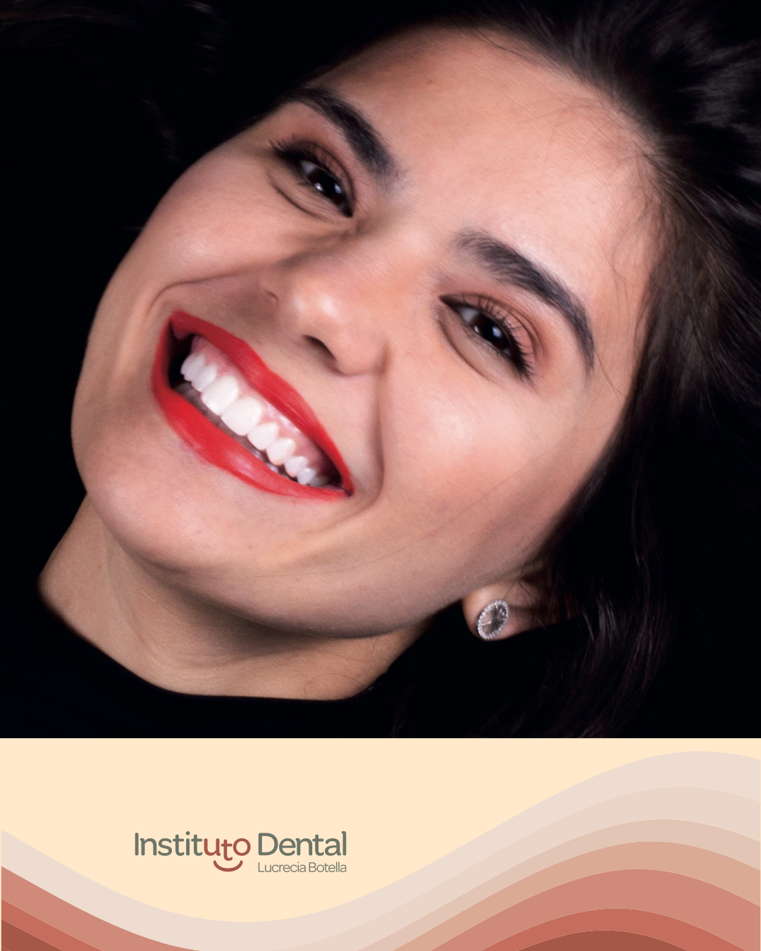 Carillas guiadas FirstFit en Torrevieja: estética dental digital precisa, rápida y mínimamente invasiva